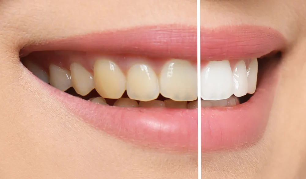 Clínica Dental Sonrisalud Calatayud - 4