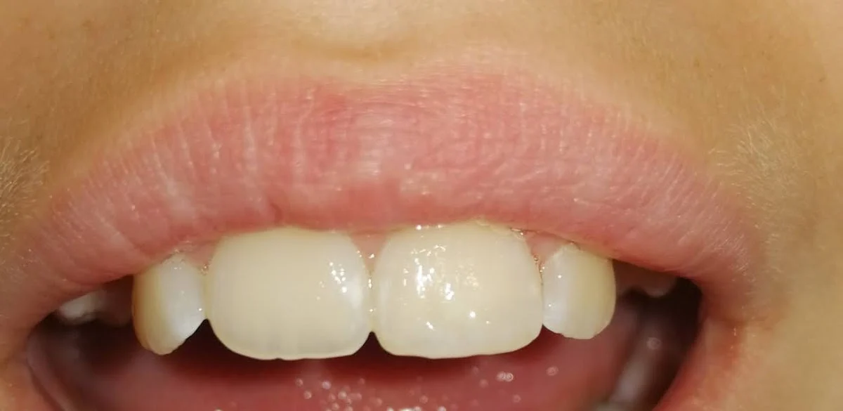 Clínica Dental Sørensen Mataró - 2