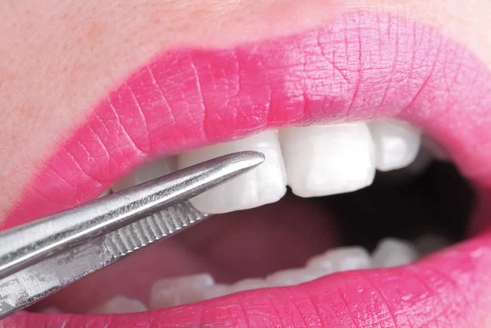 Clínica Dental Tarancón - Implantostetic - 2