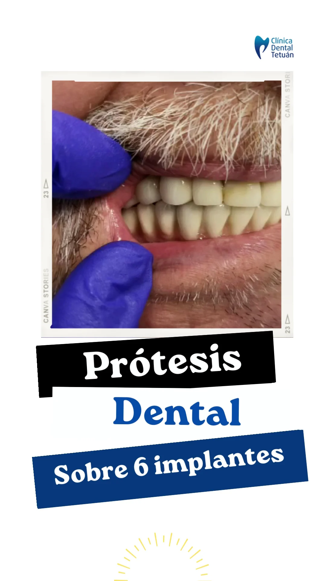 Clínica Dental Tetuán - 3