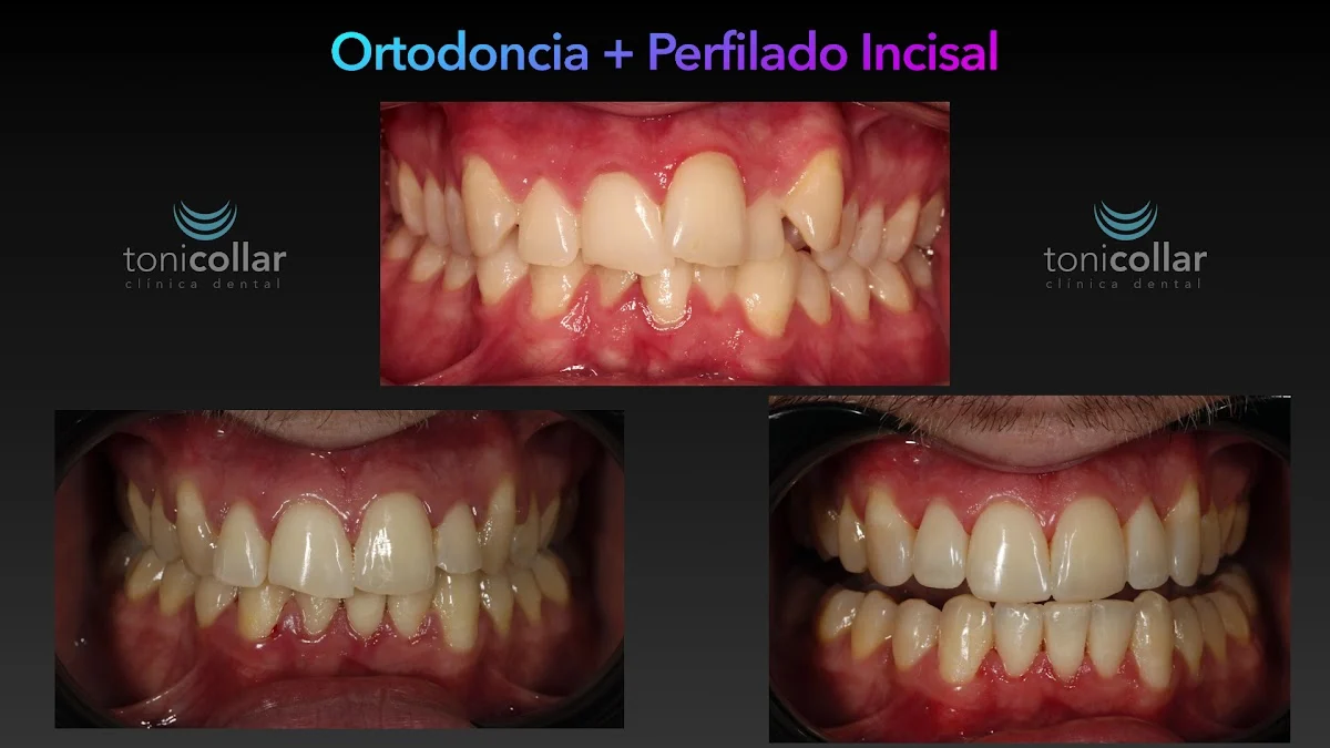 Clínica Dental Toni Collar en Gijón - 3