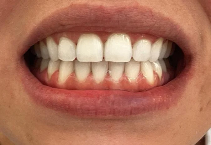 Clínica Dental Tortosa Montalvo