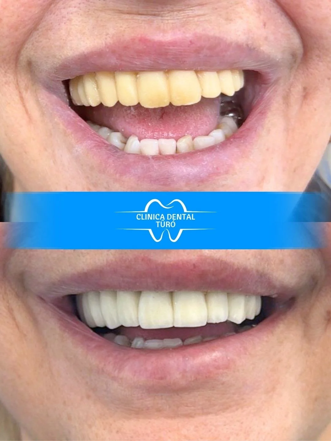 Clinica Dental Turo - 2