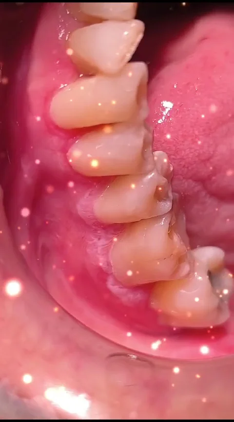 Clinica Dental Turo - 4