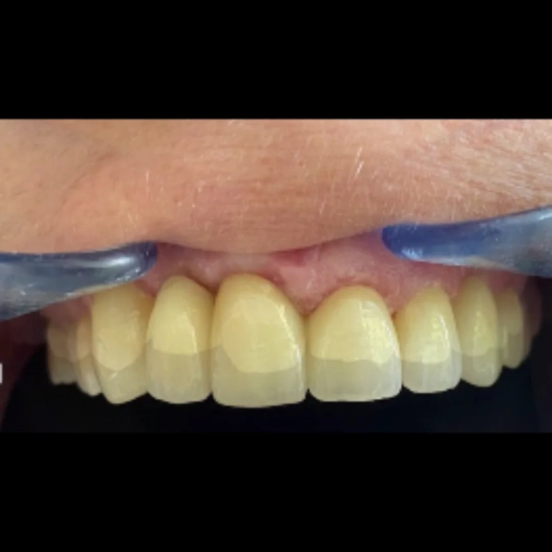 Clínica Dental UllDent - 3