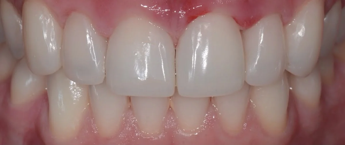 Clínica Dental Versalles - 2