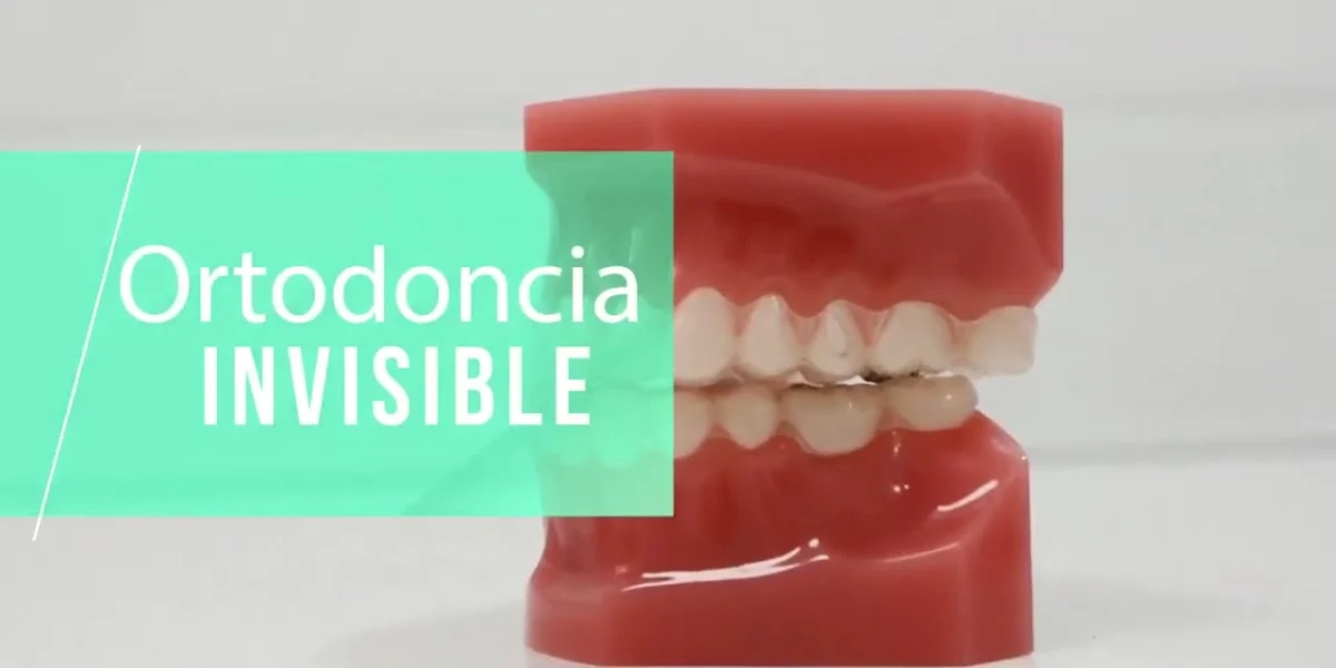 Clinica Dentaláser Dr. Alberto Cerezo - 3