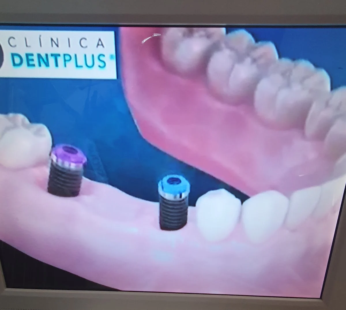 Clínica Dentplus - 2