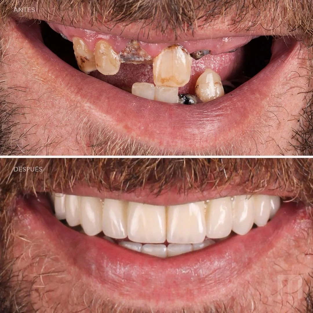 Clínica Guitián | Tu clinica dental en Vigo