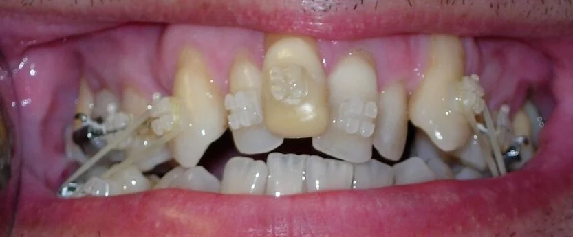 Clínica Ibaseta - 2