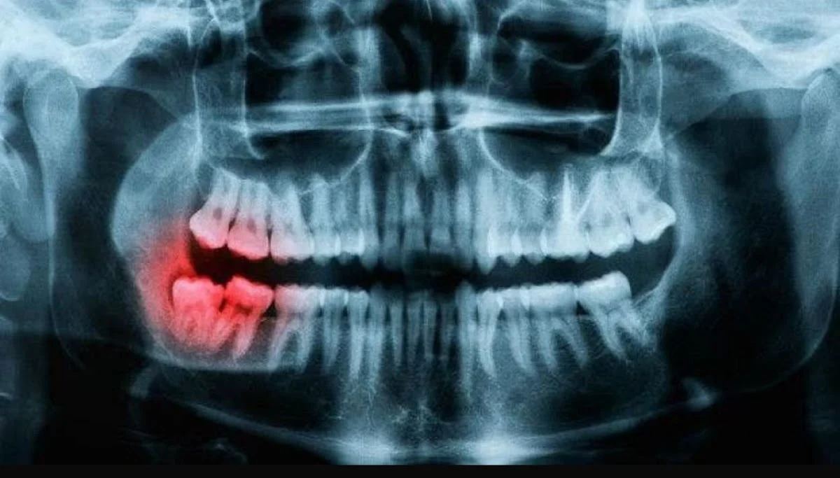 Clinica i+Dental Omar Adduo - 2