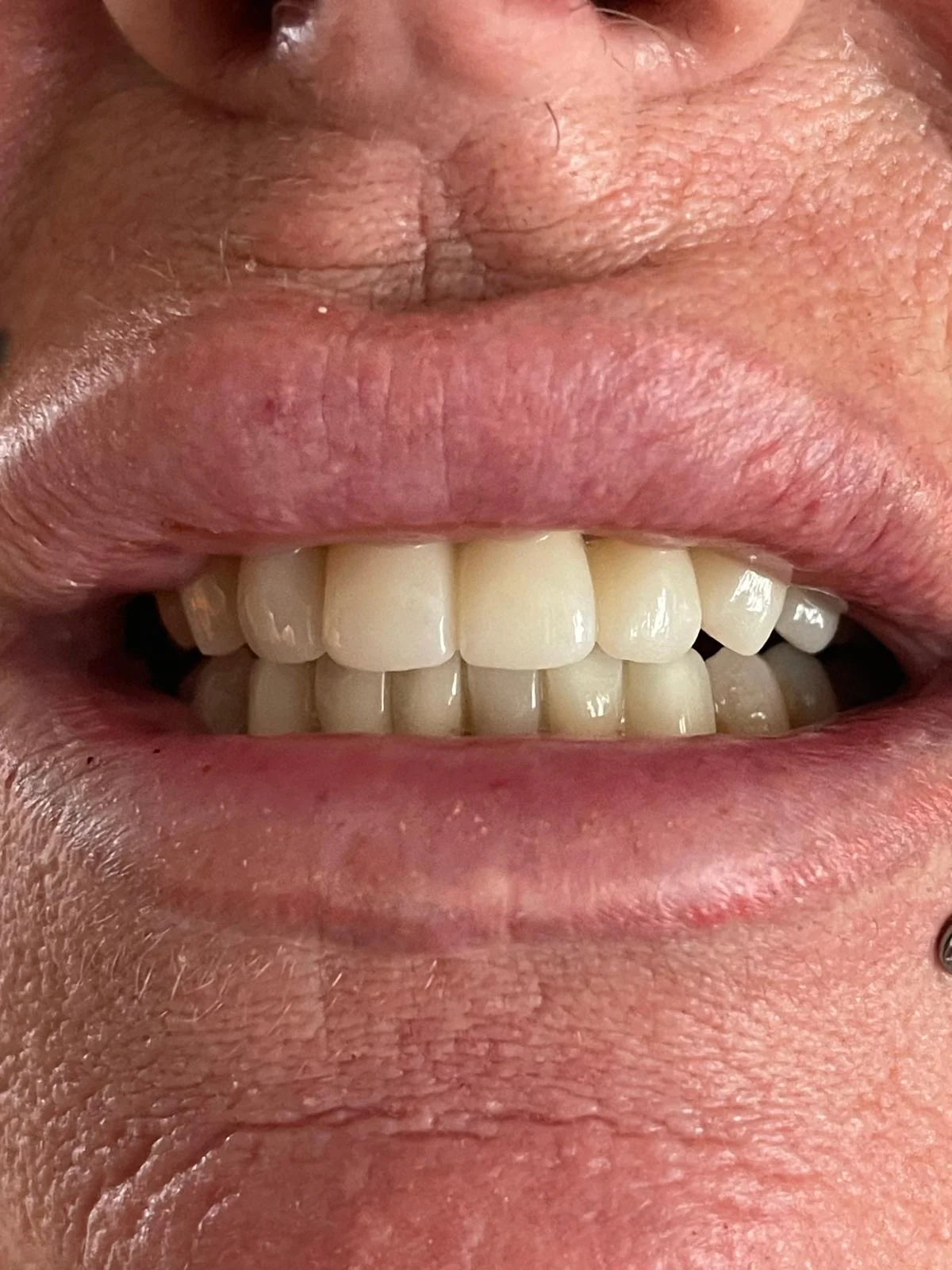 Clínica IGB Dental - ALICANTE: Implantes dentales Alicante | Clínica Dental Alicante - 4