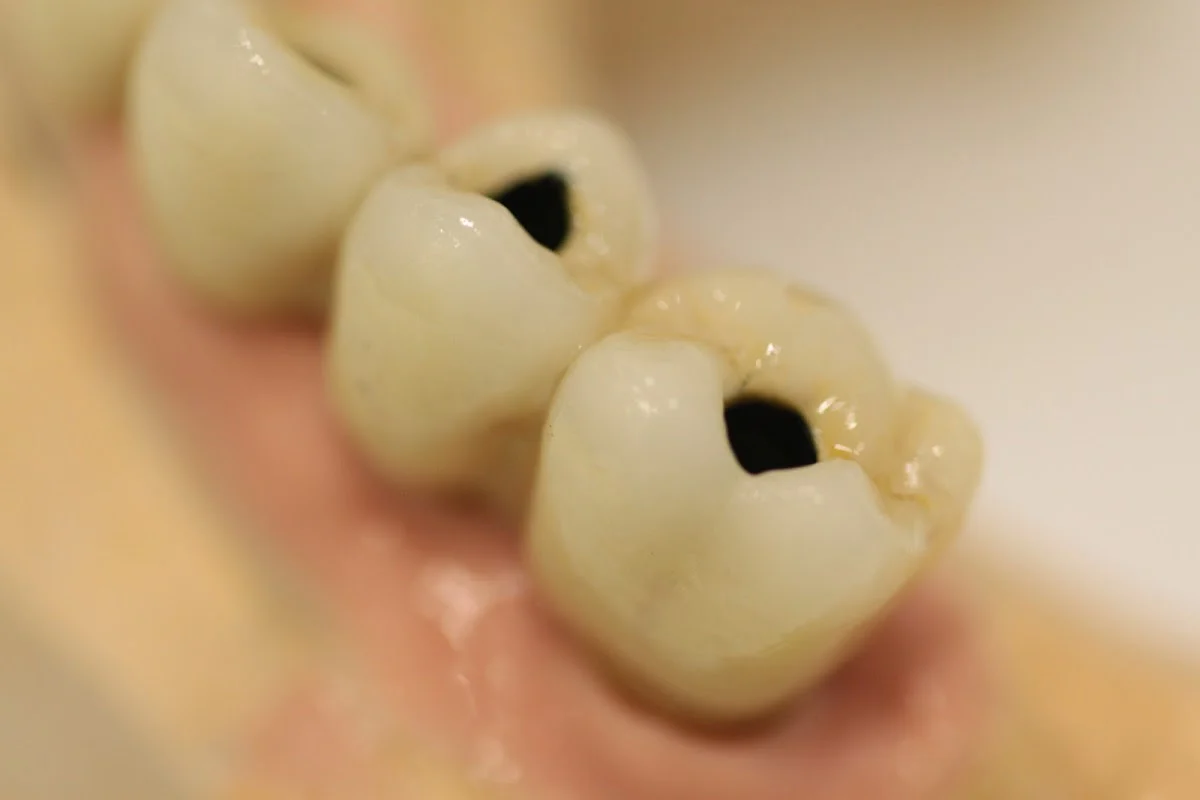 Clínica Las Torres | Clínica Dental en Rubí - 3