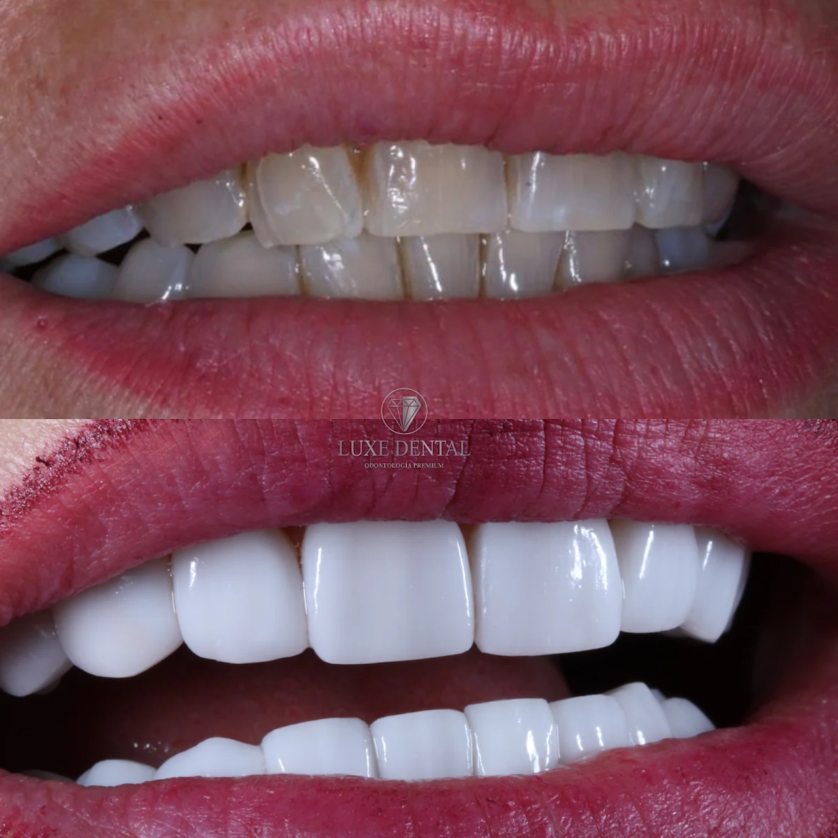 Clínica Luxe Dental Coslada - 2