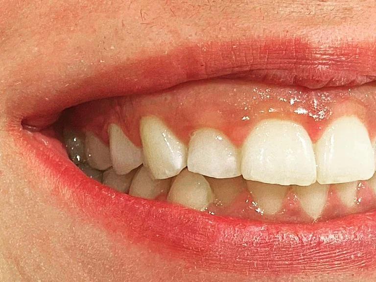 Clínica Pauels Dental | Villaviciosa de Odón - 2