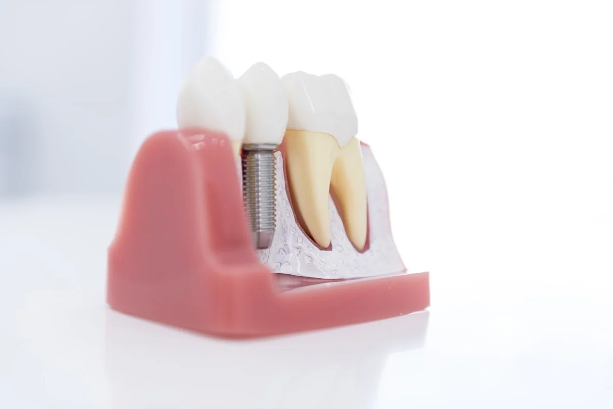 Clínica Rubal Dental - 2