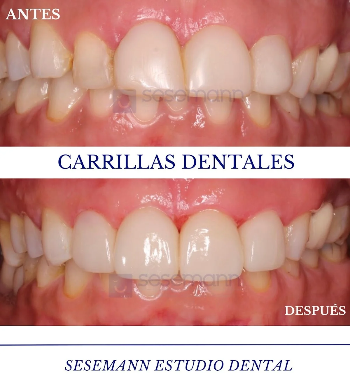 Clínica Sesemann Dental Murcia - 2