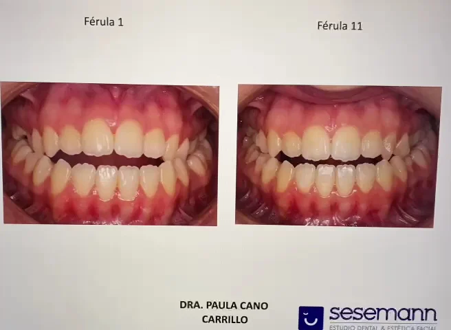 Clínica Sesemann Dental Murcia - 3