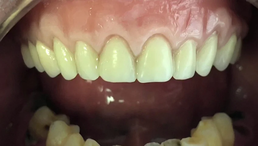 Clínica Sesemann Dental Murcia - 4