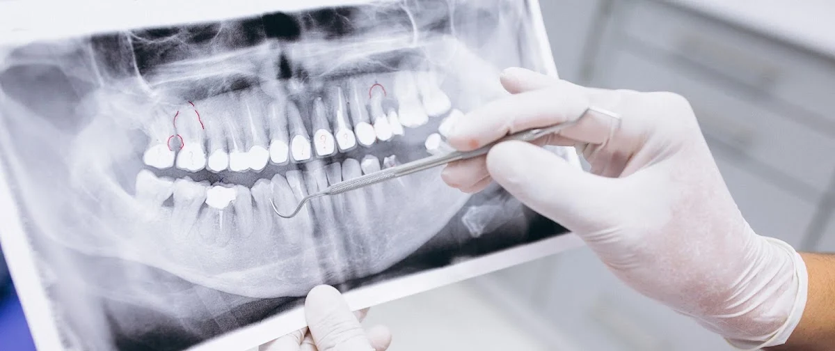 Cristina talló - Clínica dental en Figueres, Ortodoncia invisible - 2