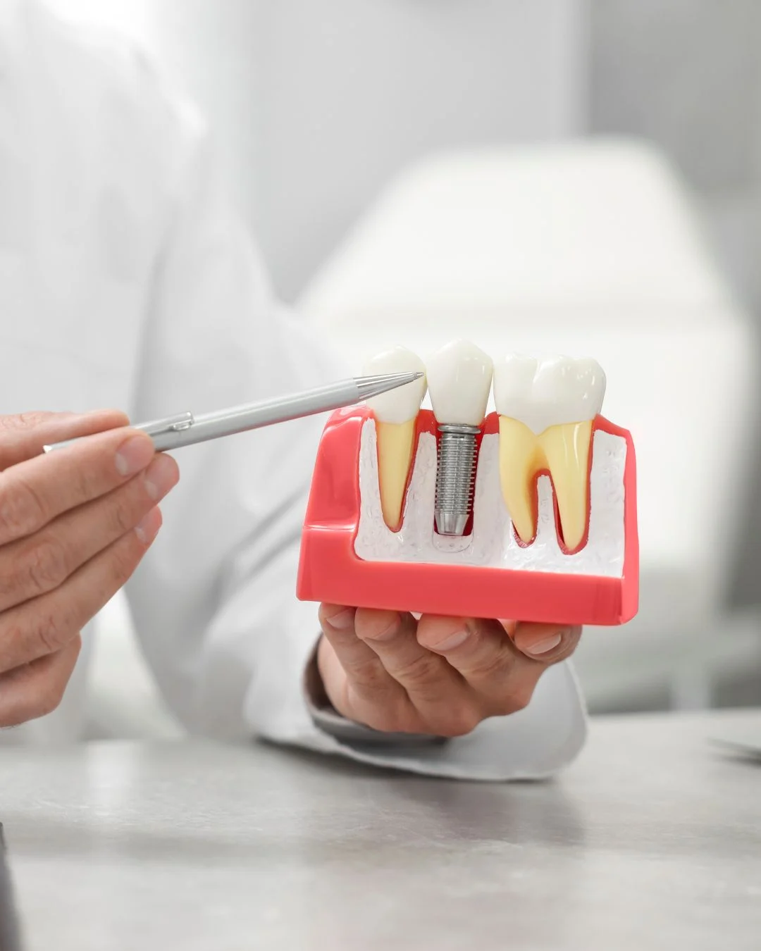 De la Torre Clínica Dental | Dentista en Torrevieja - 3