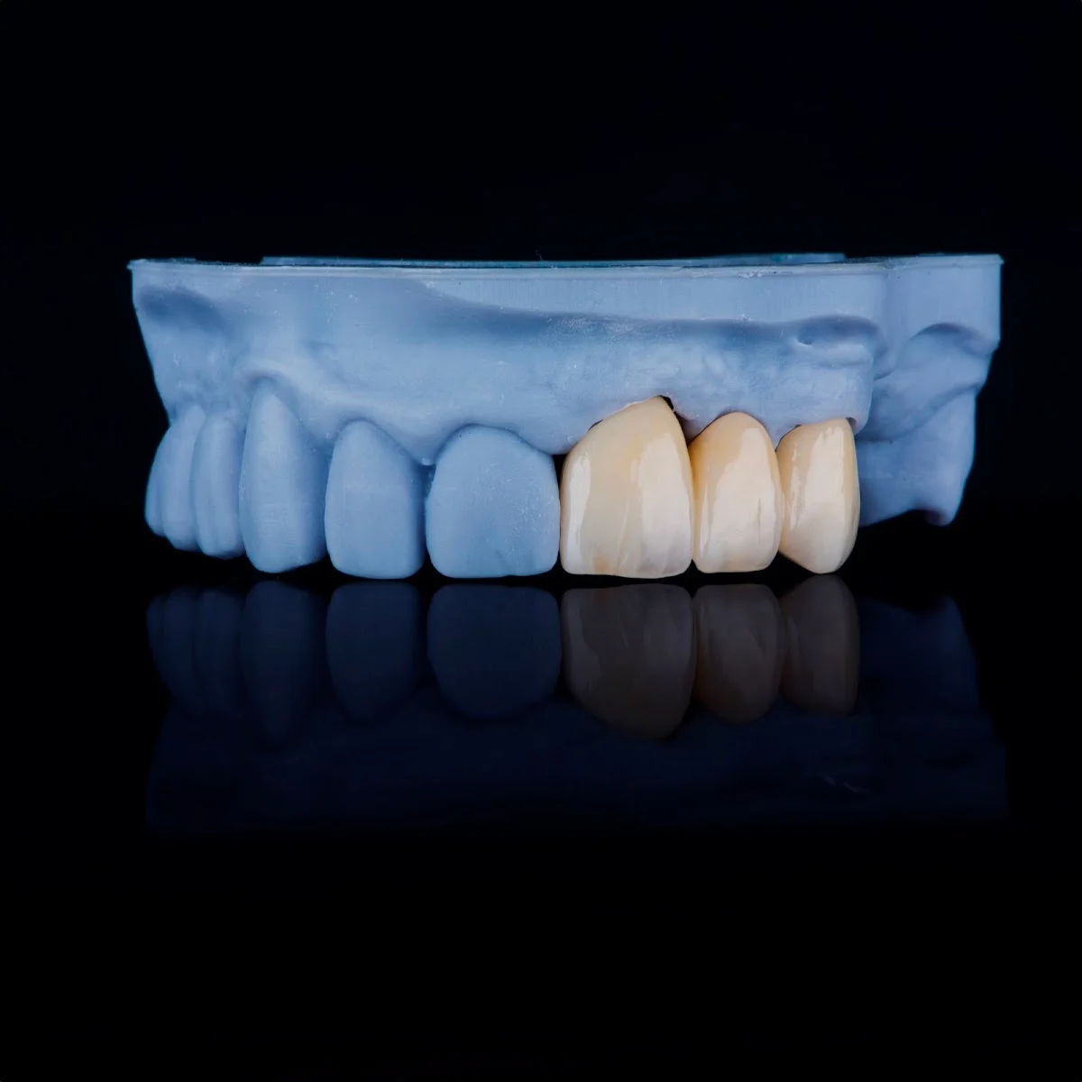 Dental Experience - 2