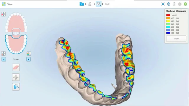 Dental Lesseps | Clínica Dental - 2