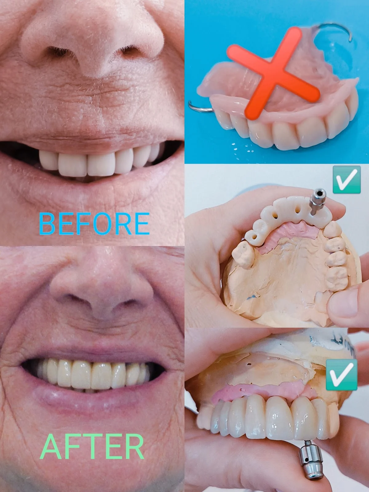 Dental Planet Implant Centre Spain - 2