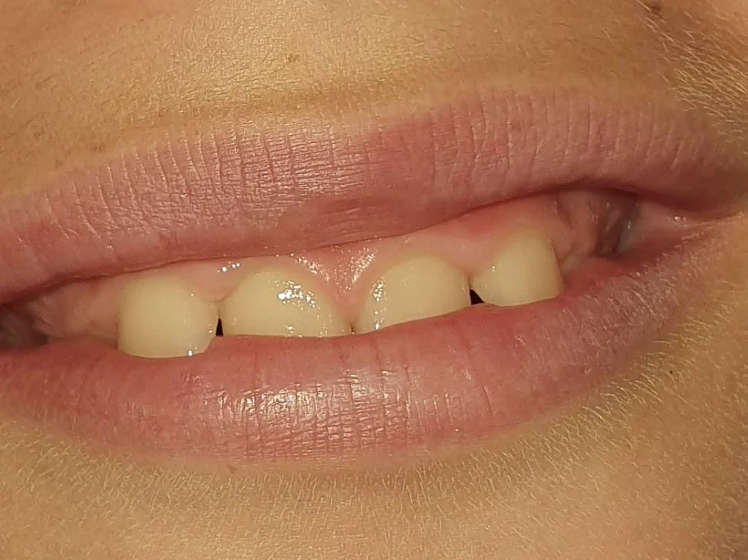 Dental Point - 2