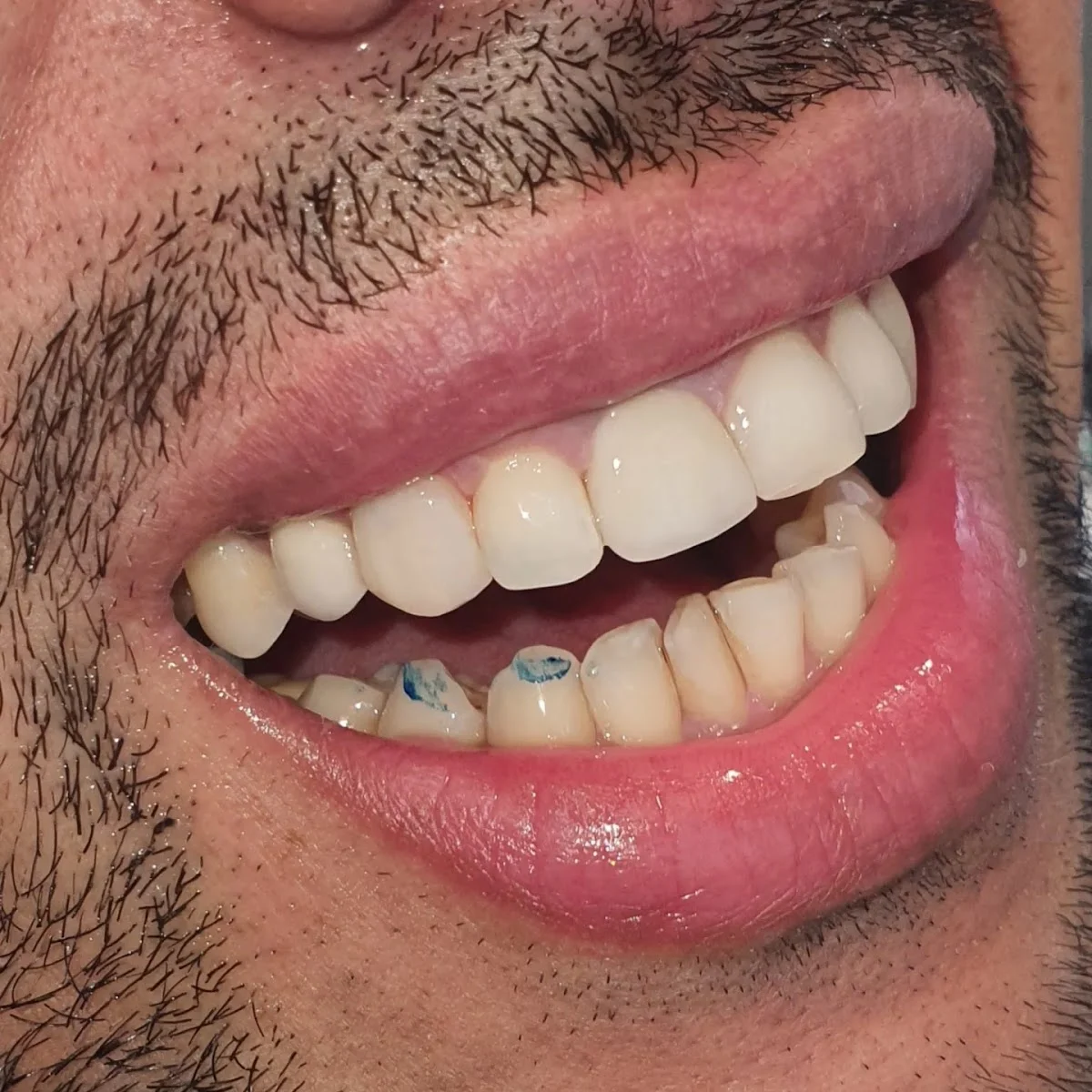 Dental Point - 3