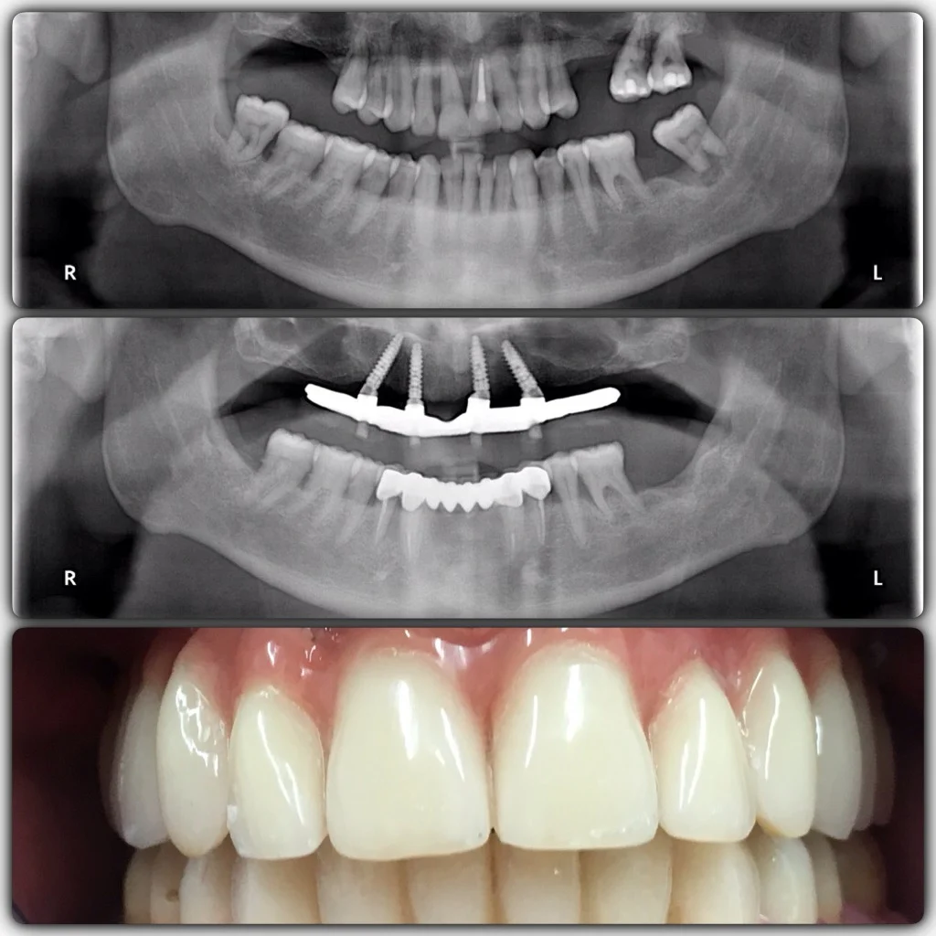 Dental Pozuelo - Clínica Dr. Menéndez - 2