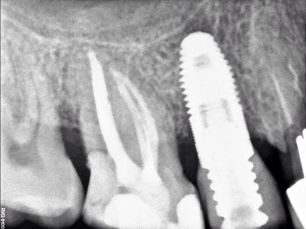 Dental Pozuelo - Clínica Dr. Menéndez - 3