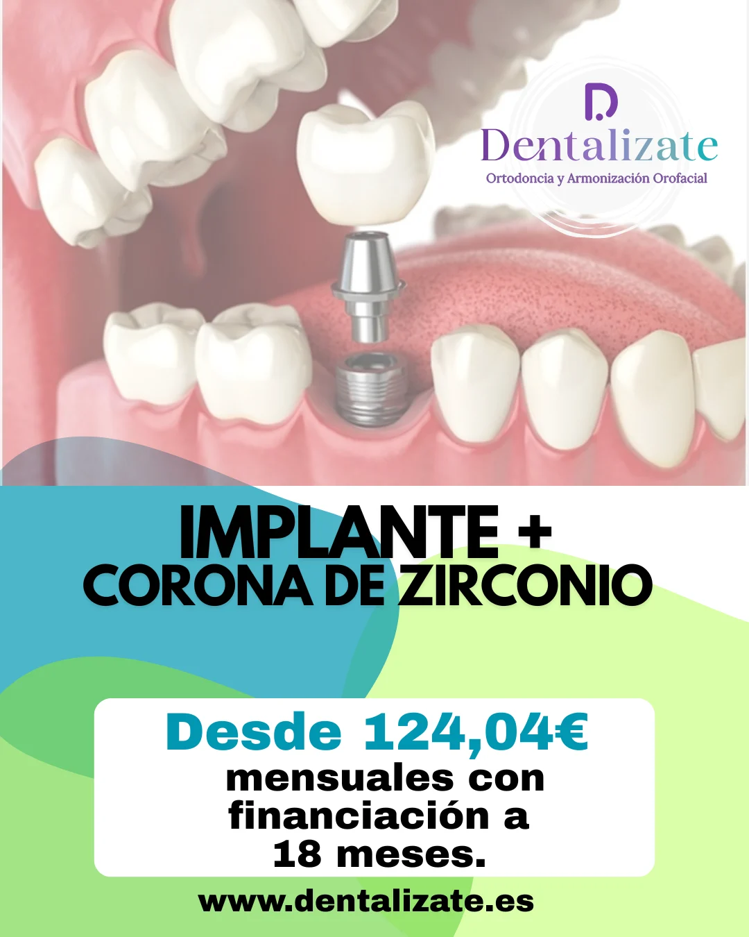 Dentalízate - Clínica de Ortodoncia y Armonización Orofacial - 2