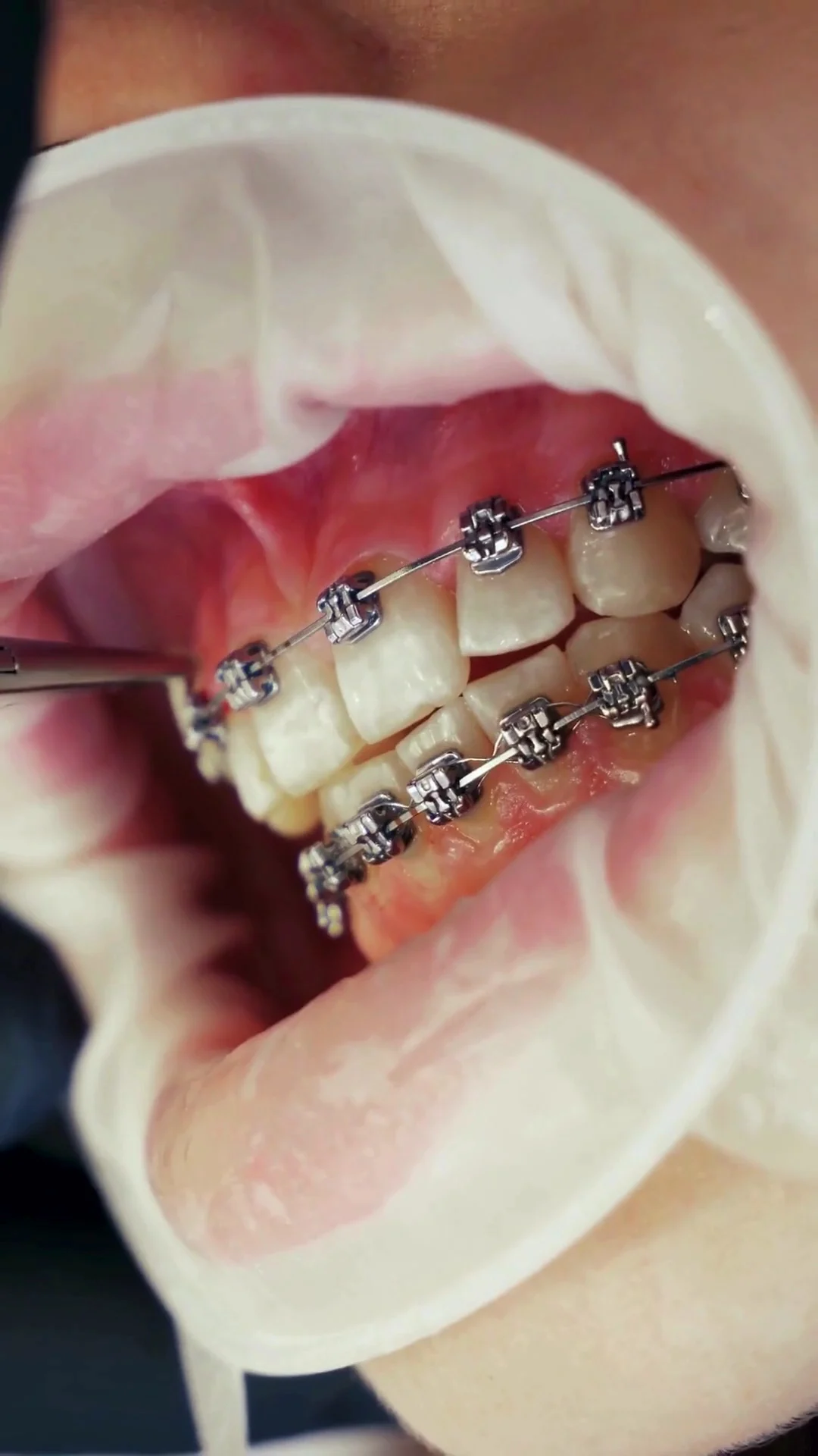 Dentalízate - Clínica de Ortodoncia y Armonización Orofacial - 3