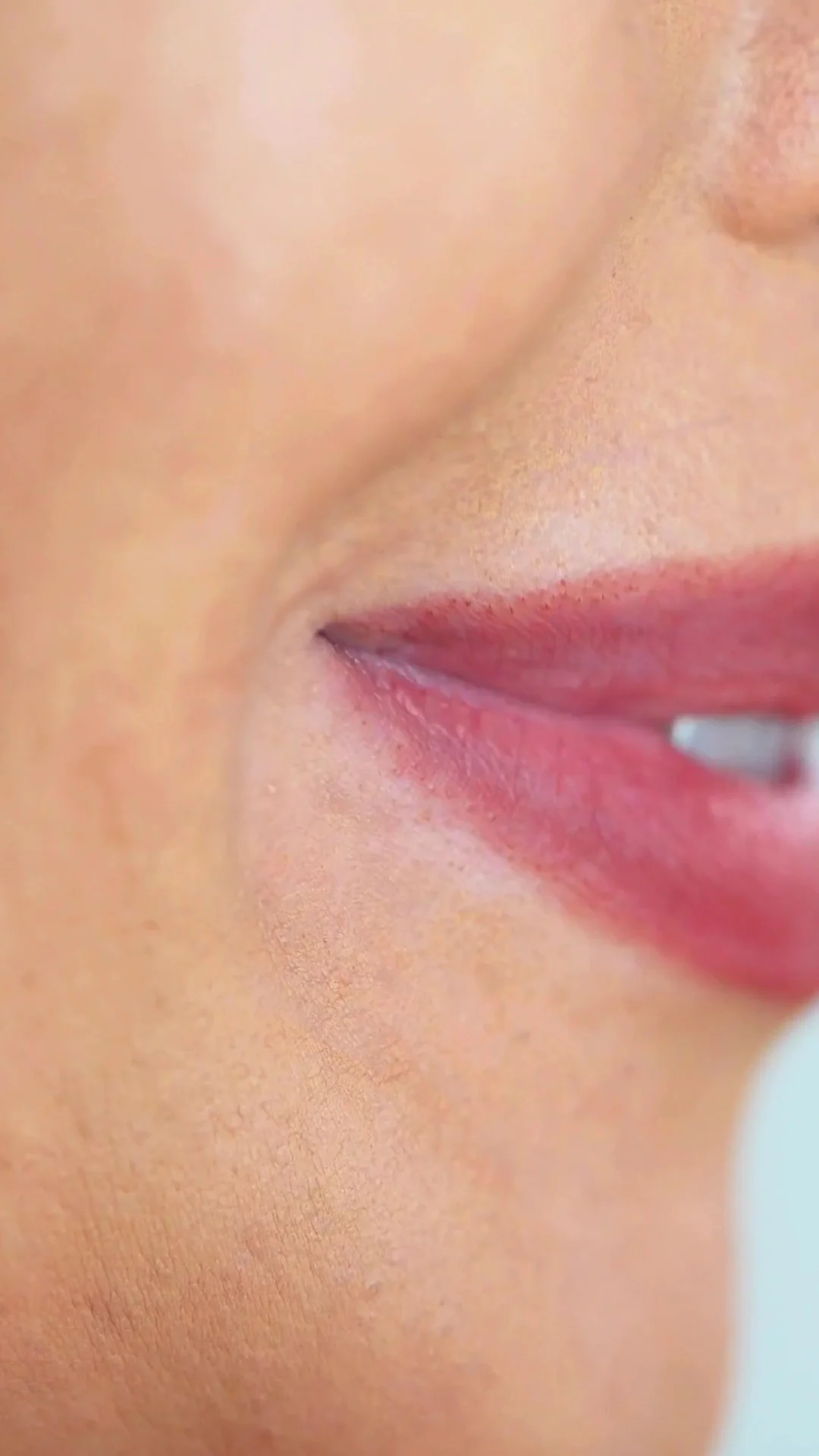 Dentalízate - Clínica de Ortodoncia y Armonización Orofacial - 4