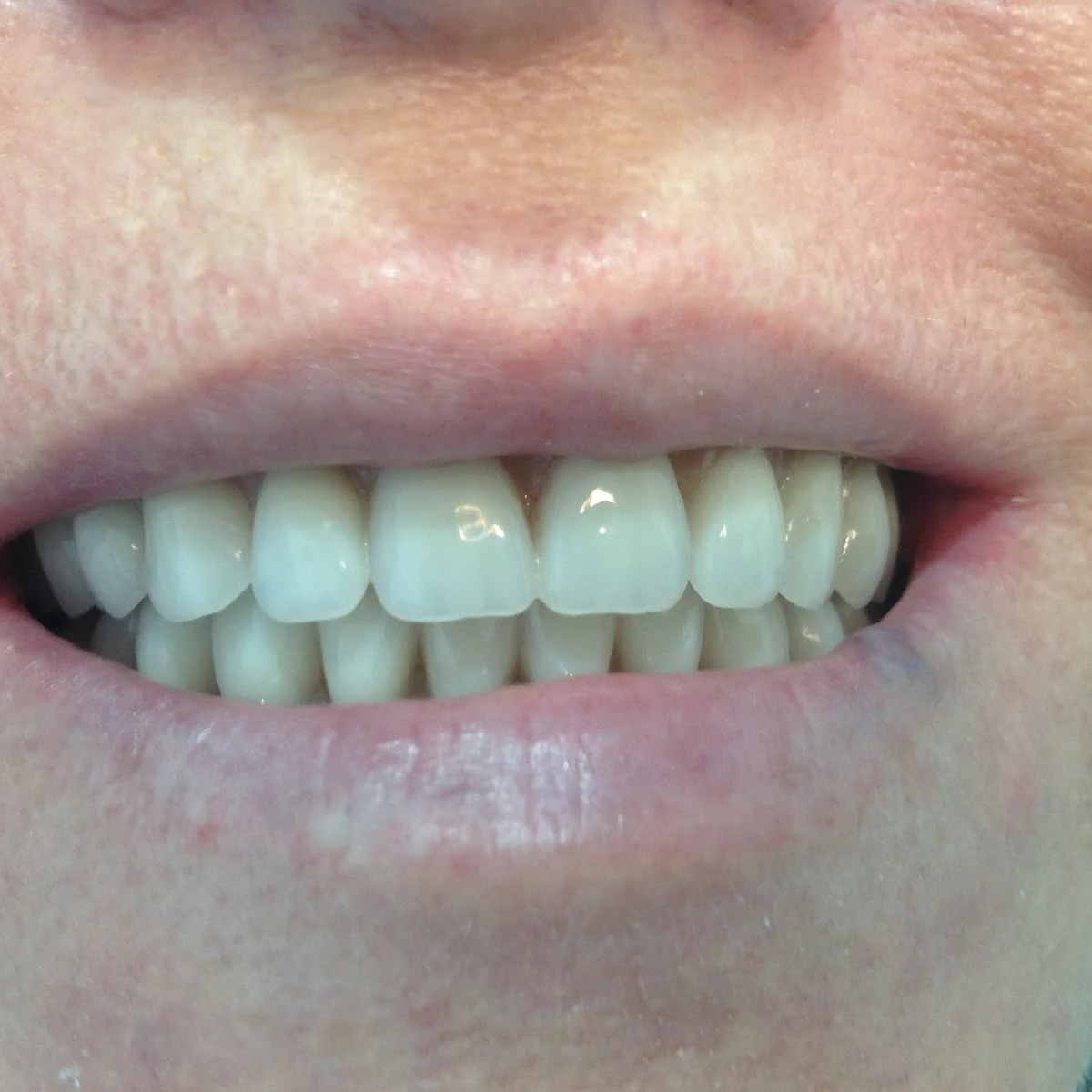 DENTALMC clinica dental ODONTO-AZUQUECA - 2