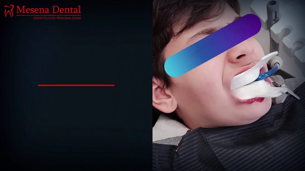Dentista Madrid Clínica dental Mesena Dental - 2
