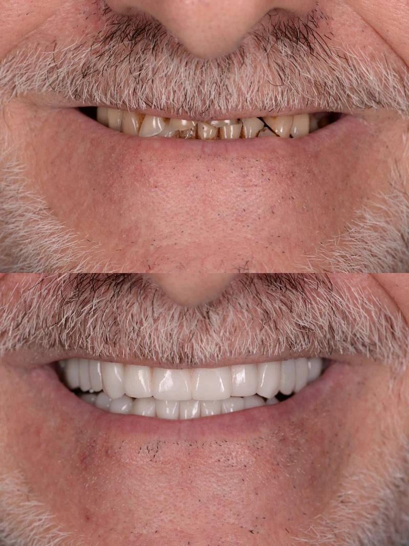 Dentista Viladecans - Clinica Dental Viladecans - 2