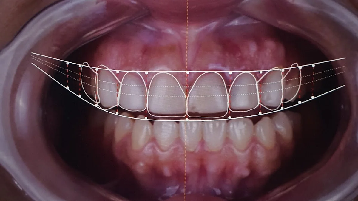 Dentius - 2