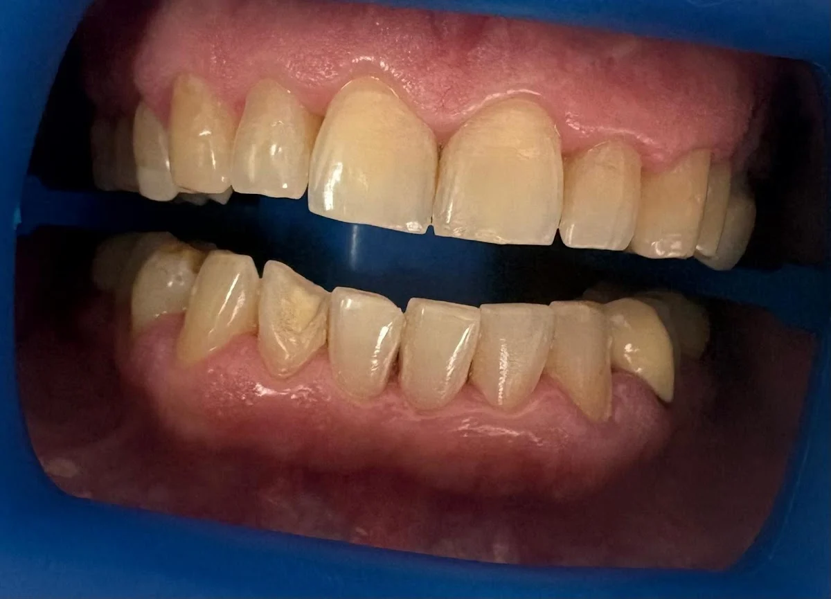 Dentsalud by Marizel Ospitia - 2