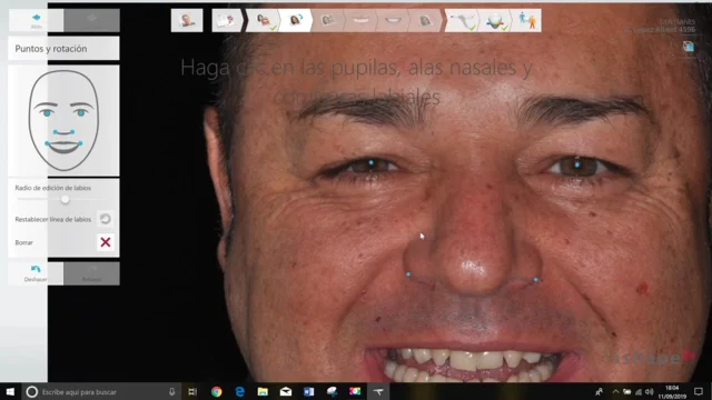 DentSanes Clínica de estética dental y facial - 4
