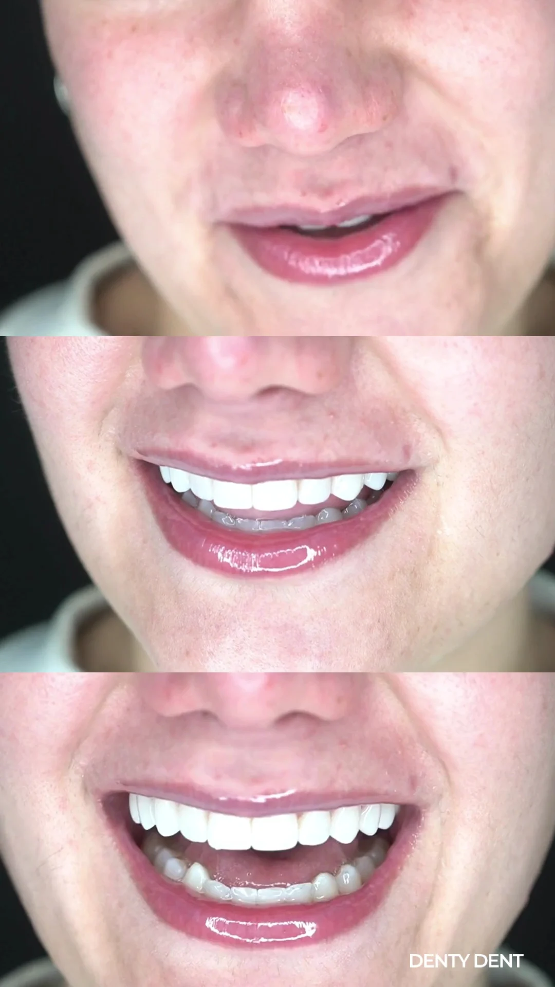 Denty Dent - Bravo Murillo - 3