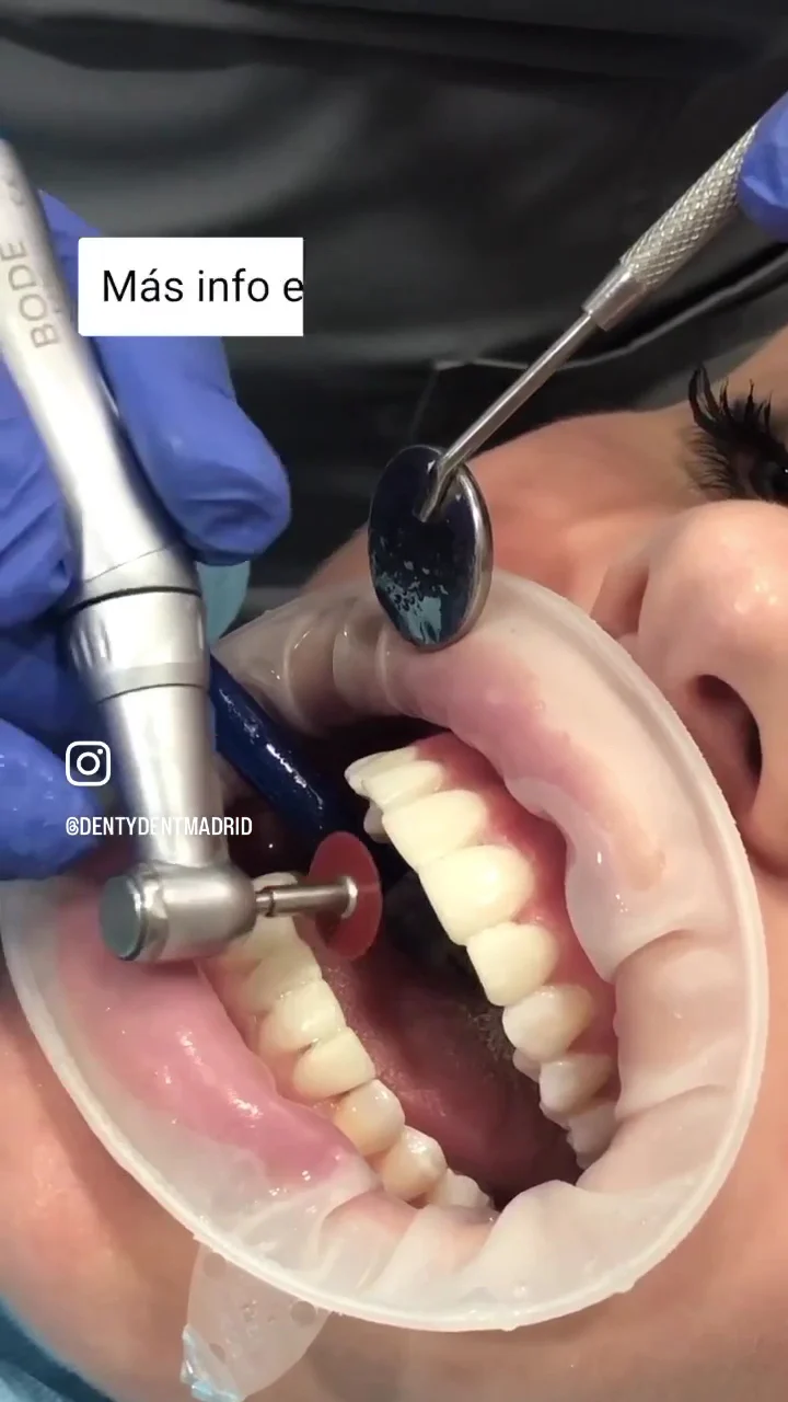 Denty Dent - Pueblo Nuevo - 3