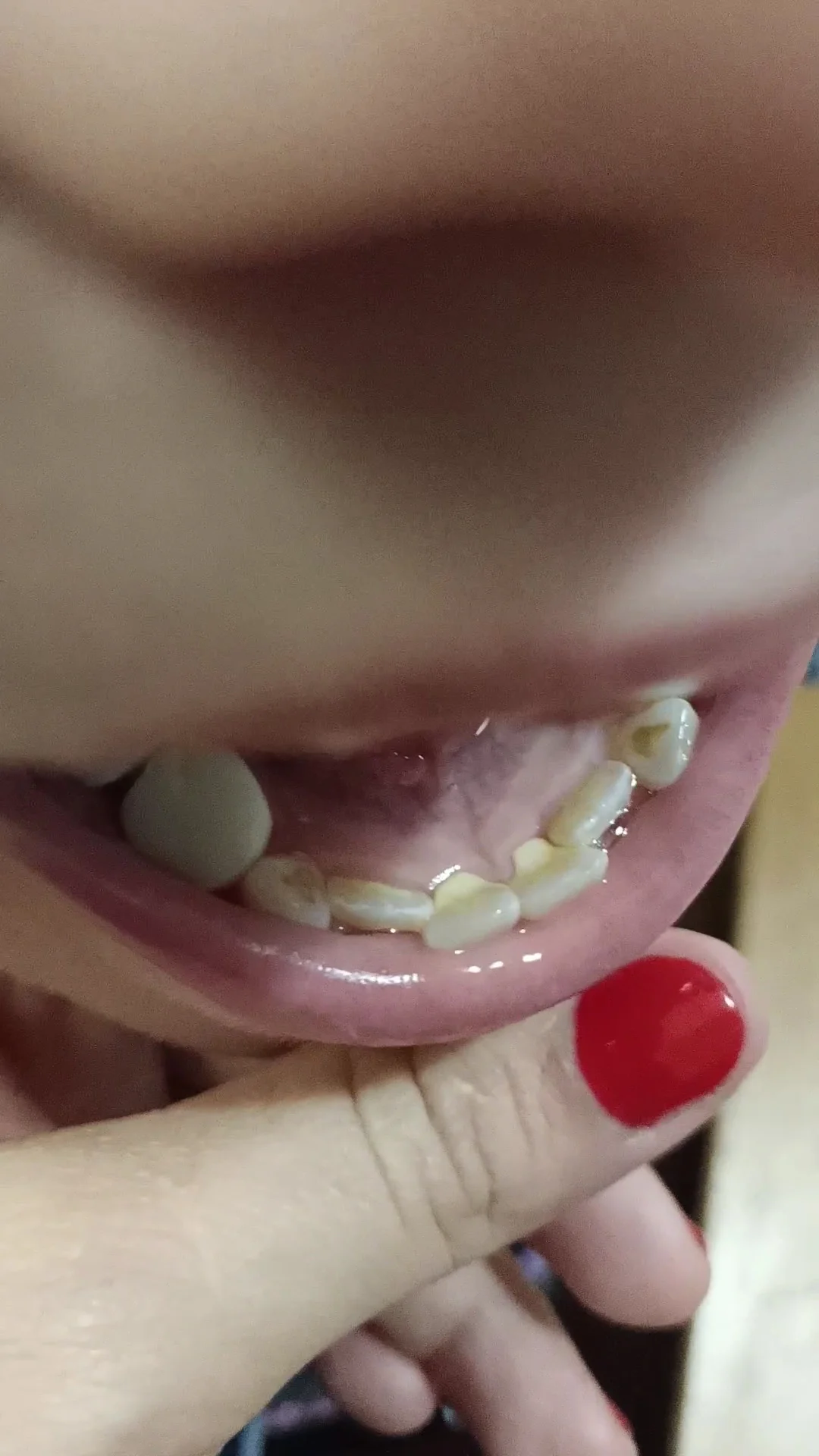 Dotu Salud Dental | Clínica Dental Huesca, Ortodoncia, Implantes, Cirugía, Dentista - 3