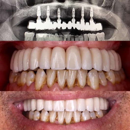 Dr. Paco Dominguez Moreno, Dentista