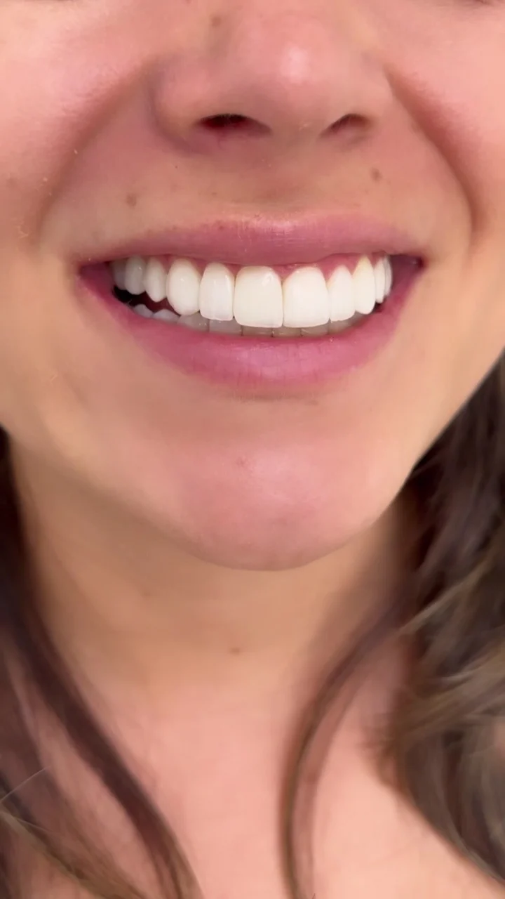 Dra. Vanessa Velásquez | Clínica dental y estética facial - 3