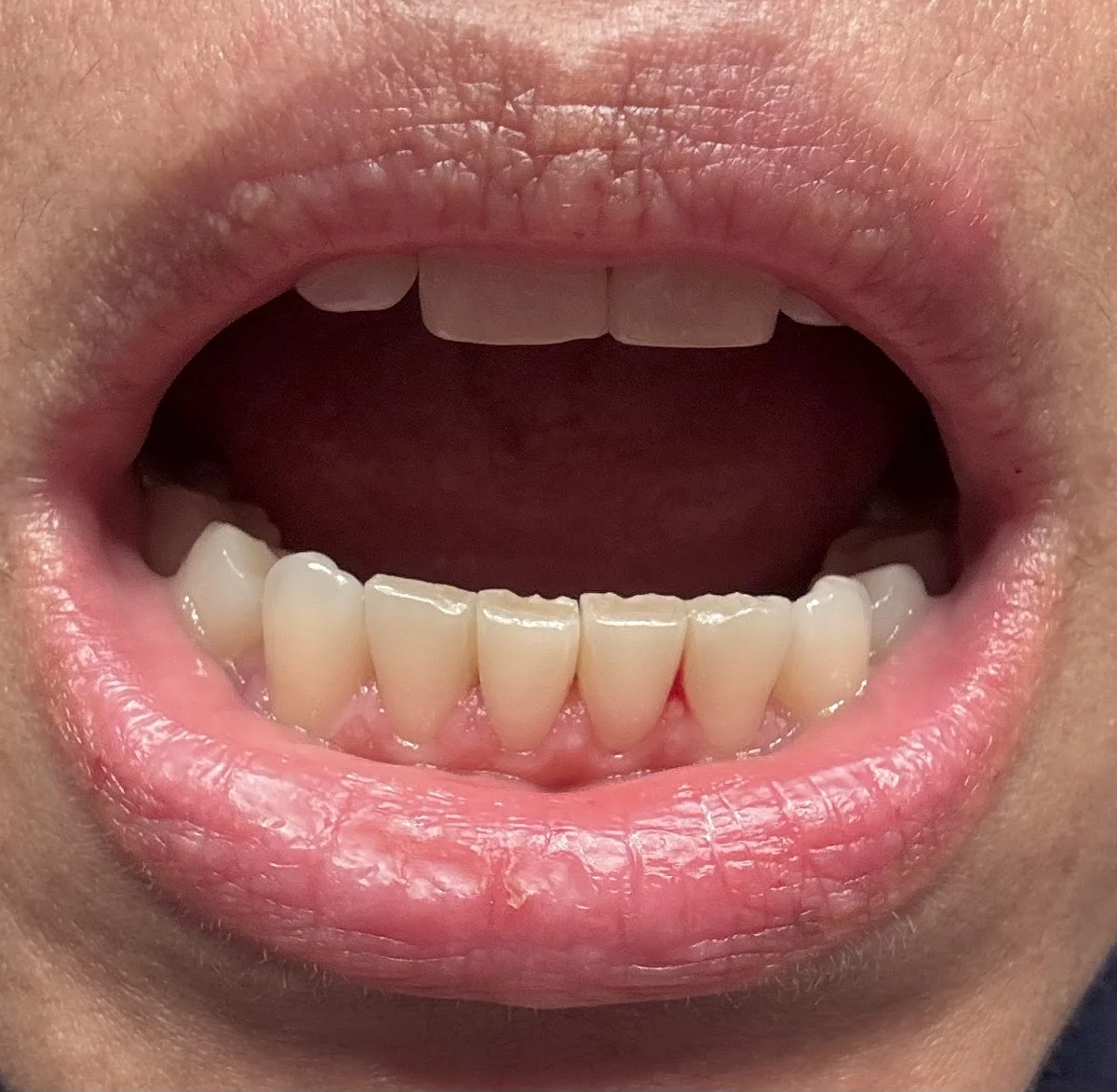 Estudi Dental Barcelona - 2