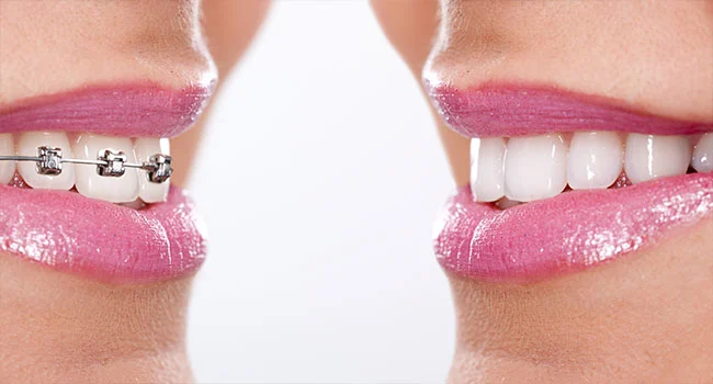 Familydent * Clínica Dental en Blanes | Carillas Dentales | Puentes dentales | Ortodoncia | Laboratorio