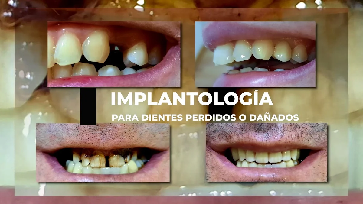 Fernando Cabaleiro CLINICA DENTAL - 3