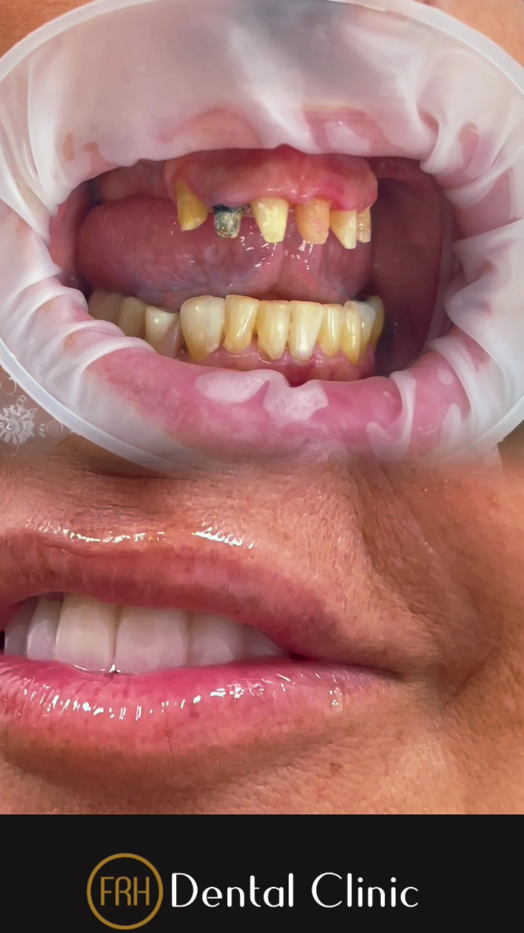 FRH DENTAL CLINIC TORREMOLINOS